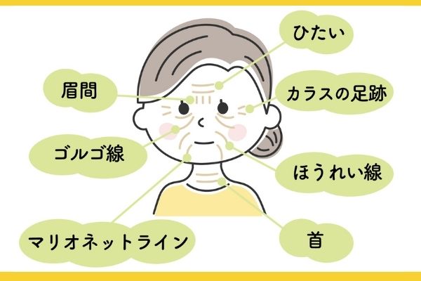 ゴルゴ線
